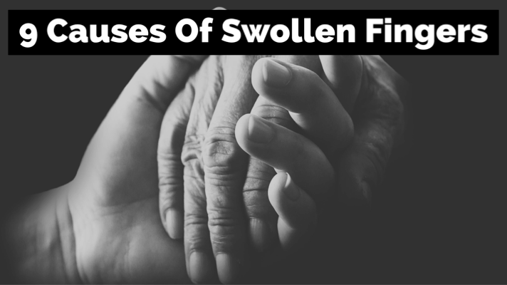 9 Causes Of Swollen&nbsp;Fingers
